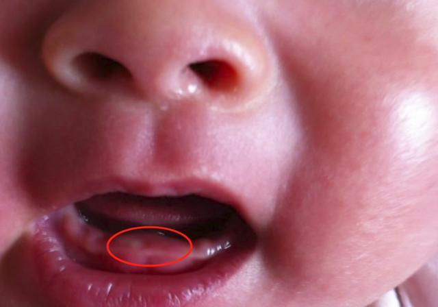 宝宝几个月长牙正常？这份宝宝“乳牙萌发和护理表”，请家长收下